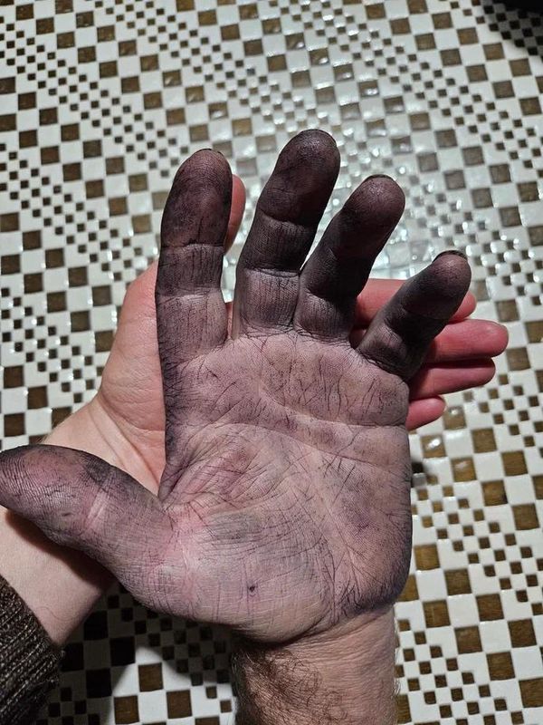 Фотоконкурс в рамках Премии Голицына. Дмитрий Гайдашев. Рука Фотоконкурс в рамках Премии Голицына. Дмитрий Гайдашев. Рука